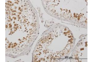 Immunoperoxidase of monoclonal antibody to BOLL on formalin-fixed paraffin-embedded human testis. (BOLL Antikörper  (AA 185-283))