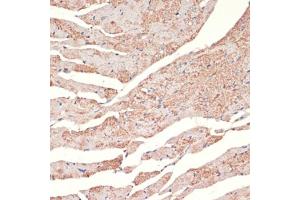 Immunohistochemistry (IHC) image for anti-Adrenoceptor alpha 1A (ADRA1A) (AA 346-475) antibody (ABIN1678588)
