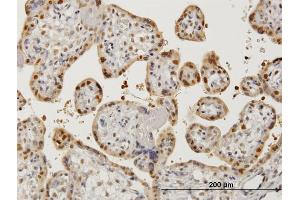 Immunoperoxidase of monoclonal antibody to AATF on formalin-fixed paraffin-embedded human placenta. (AATF Antikörper  (AA 151-250))