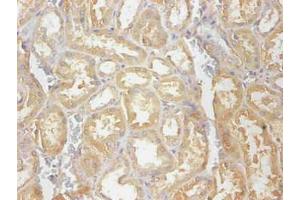 Immunohistochemical of paraffin-embedded human kidney tissue using ABIN7148973 at dilution of 1:200 (CST3 Antikörper)
