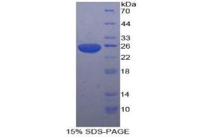 SDS-PAGE analysis of Rat SDF4 Protein. (SDF4 Protein)