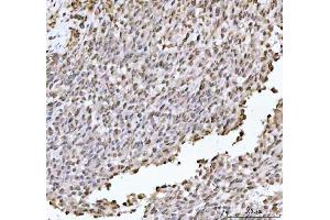IHC analysis of DHX15/prp43 using anti-DHX15/prp43 antibody (ABIN7602738).