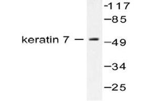 Image no. 2 for anti-Keratin 7 (KRT7) antibody (ABIN265502)
