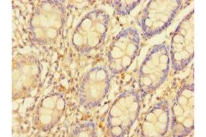 Immunohistochemistry of paraffin-embedded human colon tissue using ABIN7169844 at dilution of 1:100 (SGTB Antikörper  (AA 14-304))