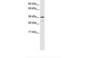 Image no. 1 for anti-Vacuolar Protein Sorting 72 Homolog (S. Cerevisiae) (VPS72) (AA 179-228) antibody (ABIN6735920)