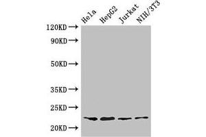 Western Blot Positive WB detected in: Hela whole cell lysate, HepG2 whole cell lysate, Jurkat whole cell lysate, NIH/3T3 whole cell lysate All lanes: RPS5 antibody at 3. (RPS5 Antikörper  (AA 1-204))