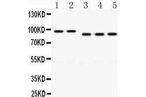 Western Blotting (WB) image for anti-Discs, Large Homolog 4 (Drosophila) (DLG4) (AA 581-724) antibody (ABIN3043563)