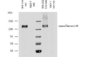 Western blotting analysis of human neurofilament M protein using mouse monoclonal antibody NF-09 on lysates of HEK-293 cell line, and MCF-7 cell line (neurofilament non-expressing cell line, negative control) under reducing and non-reducing conditions. (NEFM Antikörper)