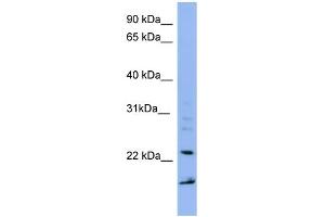 WB Suggested Anti-IMP3 Antibody Titration: 0. (IMP3 Antikörper  (Middle Region))
