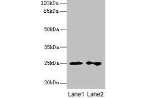 Western blot All lanes: RAB11B antibody at 2 μg/mL Lane 1: Hela whole cell lysate Lane 2: Rat gonadal tissue Secondary Goat polyclonal to rabbit IgG at 1/10000 dilution Predicted band size: 25, 20 kDa Observed band size: 25 kDa (RAB11B Antikörper  (AA 2-215))