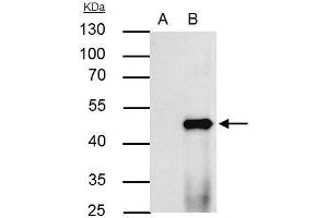 IP Image PPAR alpha antibody immunoprecipitates PPAR alpha protein in IP experiments. (PPARA Antikörper  (N-Term))