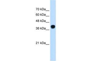 Western Blotting (WB) image for anti-Squalene Epoxidase (SQLE) antibody (ABIN2462528) (SQLE Antikörper)