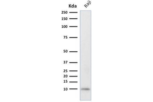 Ubiquitin B Antikörper  (AA 1-119)