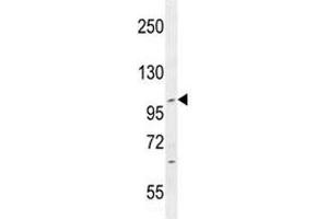 IFT88 antibody western blot analysis in CEM lysate. (IFT88 Antikörper  (AA 791-820))