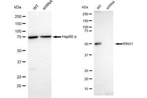 Western blotting analysis using RING1 antibody (ABIN7800240).