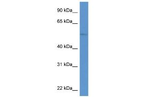 WB Suggested Anti-ZIC3 Antibody Titration:  0. (ZIC3 Antikörper  (N-Term))