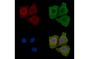 ABIN6255918 and ABIN6267675 staining Hela cells(serum starvation) by IF/ICC.