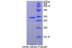 SDS-PAGE analysis of Mouse Fucosyltransferase 4 Protein. (CD15 Protein)