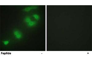 Immunofluorescence analysis of HepG2 cells, using CREBZF polyclonal antibody . (CREBZF Antikörper)