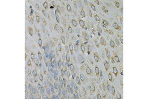 Immunohistochemistry of paraffin-embedded human esophagus using RPLP0 Antibody. (RPLP0 Antikörper)