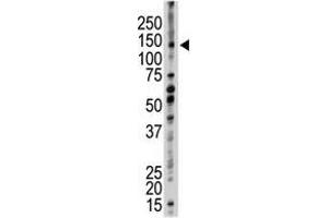 Image no. 1 for anti-Ubiquitin Conjugation Factor E4 B (UBE4B) (N-Term) antibody (ABIN357483) (UBE4B Antikörper  (N-Term))
