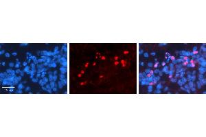 RORA antibody - middle region          Formalin Fixed Paraffin Embedded Tissue:  Human Pineal Tissue    Observed Staining:  Nucleus in Human Pineal Tissue   Primary Antibody Concentration:  1:100    Other Working Concentrations:  1/600    Secondary Antibody:  Donkey anti-Rabbit-Cy3    Secondary Antibody Concentration:  1:200    Magnification:  20X    Exposure Time:  0. (RORA Antikörper  (Middle Region))