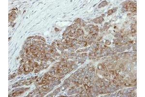 IHC-P Image Immunohistochemical analysis of paraffin-embedded Cal27 xenograft, using NR0B1, antibody at 1:100 dilution. (NR0B1 Antikörper)