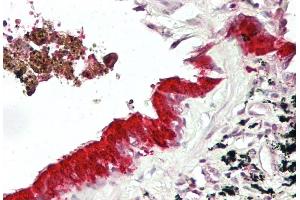 IHC Suggested Anti-MXI1 antibody  Titration: 5ug/ ml Positive Control: Lung, respiratory epithelium (MXI1 Antikörper  (Middle Region))