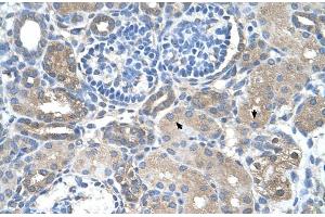 Rabbit Anti-SARDH Antibody  Paraffin Embedded Tissue: Human Kidney Cellular Data: Epithelial cells of renal tubule Antibody Concentration: 4.
