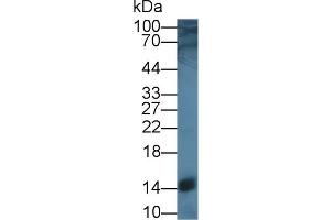 Western Blot; Sample: Rat Liver lysate; Primary Ab: 1µg/ml Rabbit Anti-Rat SCP2 Antibody Second Ab: 0.