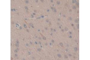 IHC-P analysis of Rat Tissue, with DAB staining. (TGM1 Antikörper  (AA 504-737))