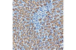 IHC analysis of RAB7/RAB7A using anti-RAB7/RAB7A antibody (ABIN7600597).