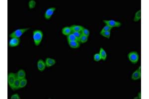 Immunofluorescent analysis of HepG2 cells using ABIN7143891 at dilution of 1:100 and Alexa Fluor 488-congugated AffiniPure Goat Anti-Rabbit IgG(H+L) (ALKBH4 Antikörper  (AA 1-115))