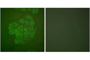 Immunofluorescence analysis of A549 cells, using GR (Ab-211) Antibody. (GR (AA 181-230) Antikörper)