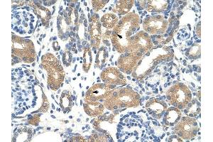 ApoBEC3D antibody was used for immunohistochemistry at a concentration of 12.