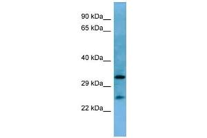 Western Blotting (WB) image for anti-Homeobox A6 (HOXA6) (N-Term) antibody (ABIN2779766)