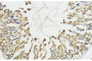 Immunohistochemistry of paraffin-embedded Rat testis using HACE1 Polyclonal Antibody at dilution of 1:100 (40x lens). (HACE1 Antikörper)