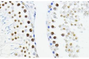 Immunohistochemistry of paraffin-embedded Rat testis using ZEB1 Polyclonal Antibody at dilution of 1:200 (40x lens). (ZEB1 Antikörper)