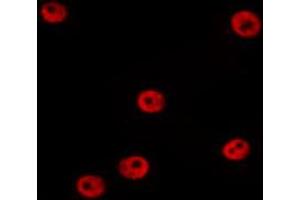 ABIN6274381 staining HepG2 by IF/ICC. (MAPK6 Antikörper  (Internal Region))