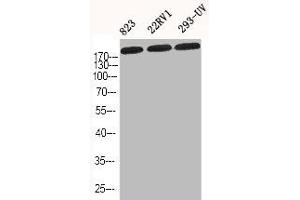 Western Blot analysis of 823 22RV1 293-UV cells using COL1A2 Polyclonal Antibody (COL1A2 Antikörper  (N-Term))