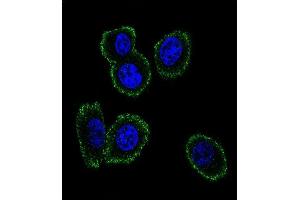 Confocal immunofluorescent analysis of NMB Antibody (Center) (ABIN651541 and ABIN2840290) with MDA-M cell followed by Alexa Fluor 488-conjugated goat anti-rabbit lgG (green).