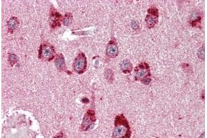Immunohistochemistry (Paraffin-embedded Sections) (IHC (p)) image for anti-Nuclear Receptor Subfamily 3, Group C, Member 2 (NR3C2) antibody (ABIN396956)