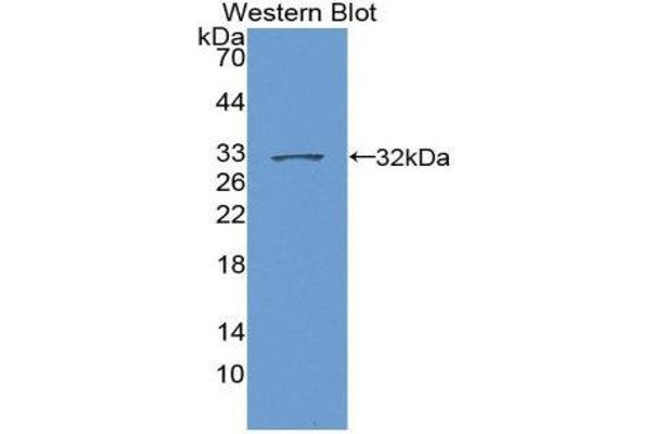 TOP2 Antikörper  (AA 1079-1328)