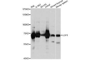 Western blot analysis of extracts of various cell lines, using LCP1 antibody. (LCP1 Antikörper  (AA 1-270))