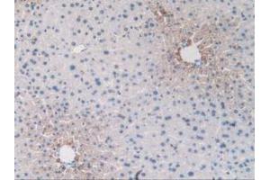 IHC-P analysis of Mouse Liver Tissue, with DAB staining. (Endoglin Antikörper  (AA 27-137))