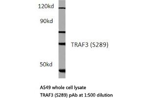 Western blot (WB) analysis of TCF-3 antibody in extracts from hela cells. (TCF3 Antikörper)