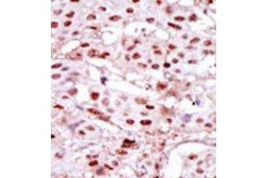 Image no. 2 for anti-Casein Kinase 2 alpha 1 (CSNK2A1) (Middle Region) antibody (ABIN360651) (CSNK2A1/CK II alpha Antikörper  (Middle Region))