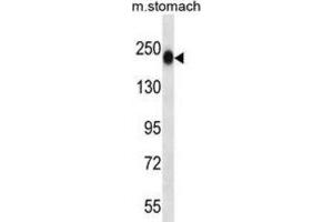 Western Blotting (WB) image for anti-Tenascin N (TNN) antibody (ABIN2997436) (Tenascin N Antikörper)