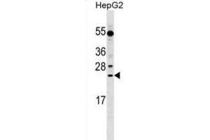 Western Blotting (WB) image for anti-Leucine Rich Repeat Containing 29 (LRRC29) antibody (ABIN2999686) (LRRC29 Antikörper)
