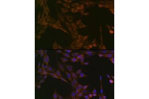 Immunofluorescence analysis of NIH-3T3 cells using SMYD3 Rabbit mAb (ABIN3015902, ABIN3015903, ABIN1680302 and ABIN1680303) at dilution of 1:100 (40x lens). (SMYD3 Antikörper)